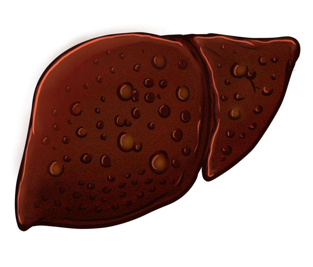 erfahren sie, wie sie ihre lebergesundheit durch eine ausgewogene ern&auml;hrung, regelm&auml;&szlig;ige bewegung und bewussten lebensstil f&ouml;rdern k&ouml;nnen.