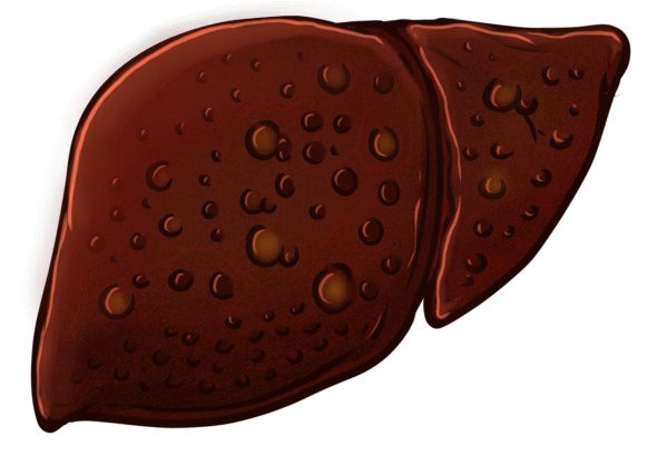 erfahren sie, wie sie ihre lebergesundheit durch eine ausgewogene ern&auml;hrung, regelm&auml;&szlig;ige bewegung und bewussten lebensstil f&ouml;rdern k&ouml;nnen.