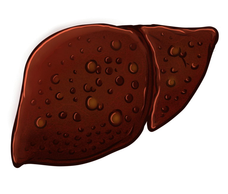 erfahren sie, wie sie ihre lebergesundheit durch eine ausgewogene ern&auml;hrung, regelm&auml;&szlig;ige bewegung und bewussten lebensstil f&ouml;rdern k&ouml;nnen.